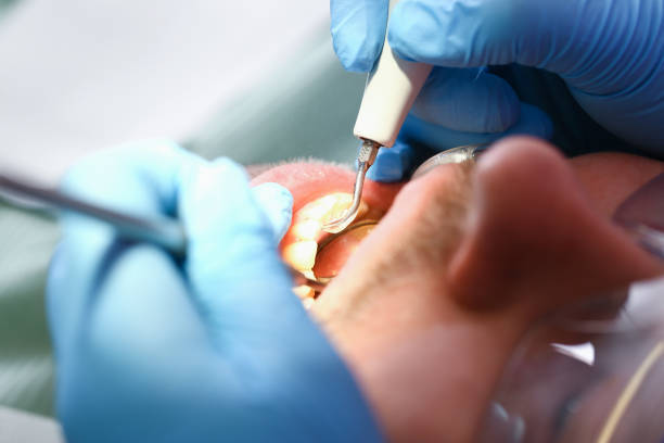 Best Emergency Treatment for Dental Infections or Abscesses in Jackson, MN