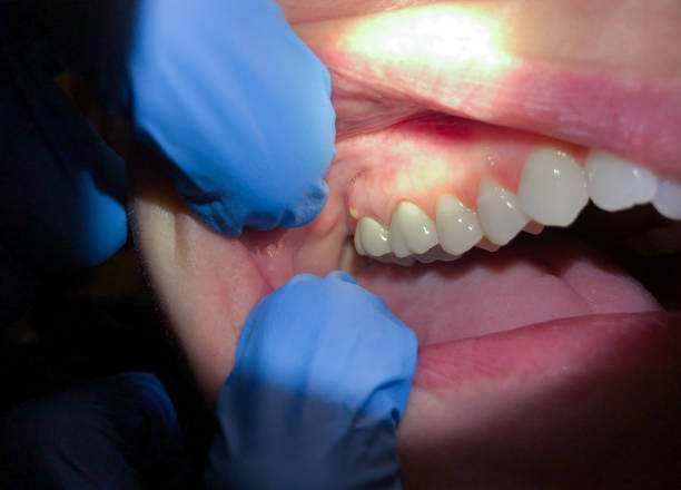 Best Emergency Gum Treatment in Jackson, MN